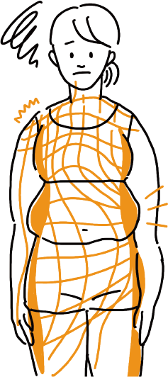 筋膜のねじれや癒着のイメージ